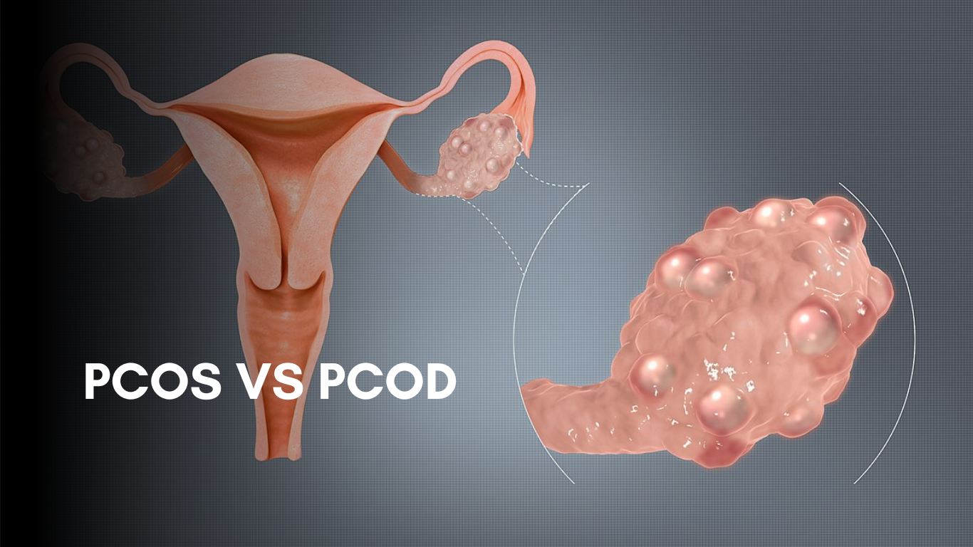PCOD vs PCOS: Understanding the Causes, Symptoms, Key Differences, and ...