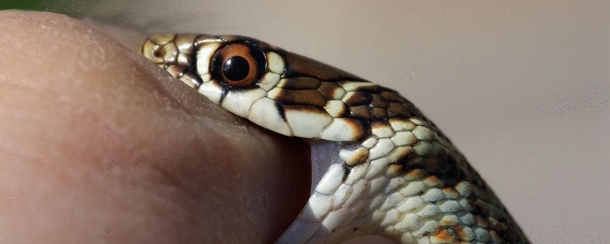 Snake Bite ICU Monitoring