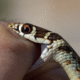 Snake Bite ICU Monitoring